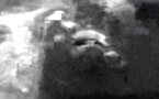 Avulsion osseuse de l' E.I.A.S.