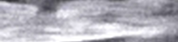 Une écharde de bois dans la paroi abdominale