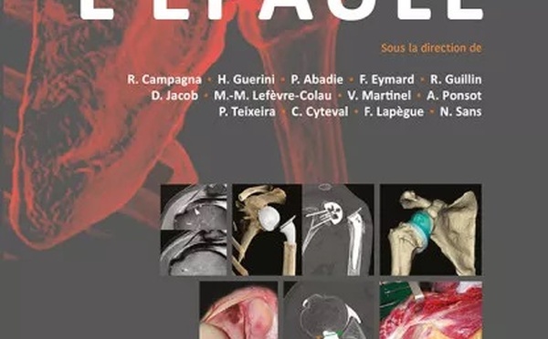 L'EPAULE